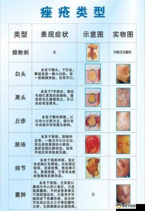 SP 发刷致红肿双丘：问题引发关注