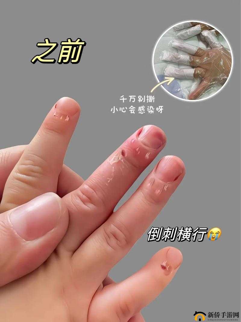 三根手指剧痛：原因及应对方法