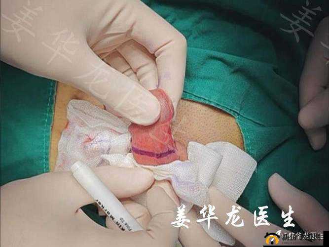 男生剥完皮到底什么样：深度揭秘
