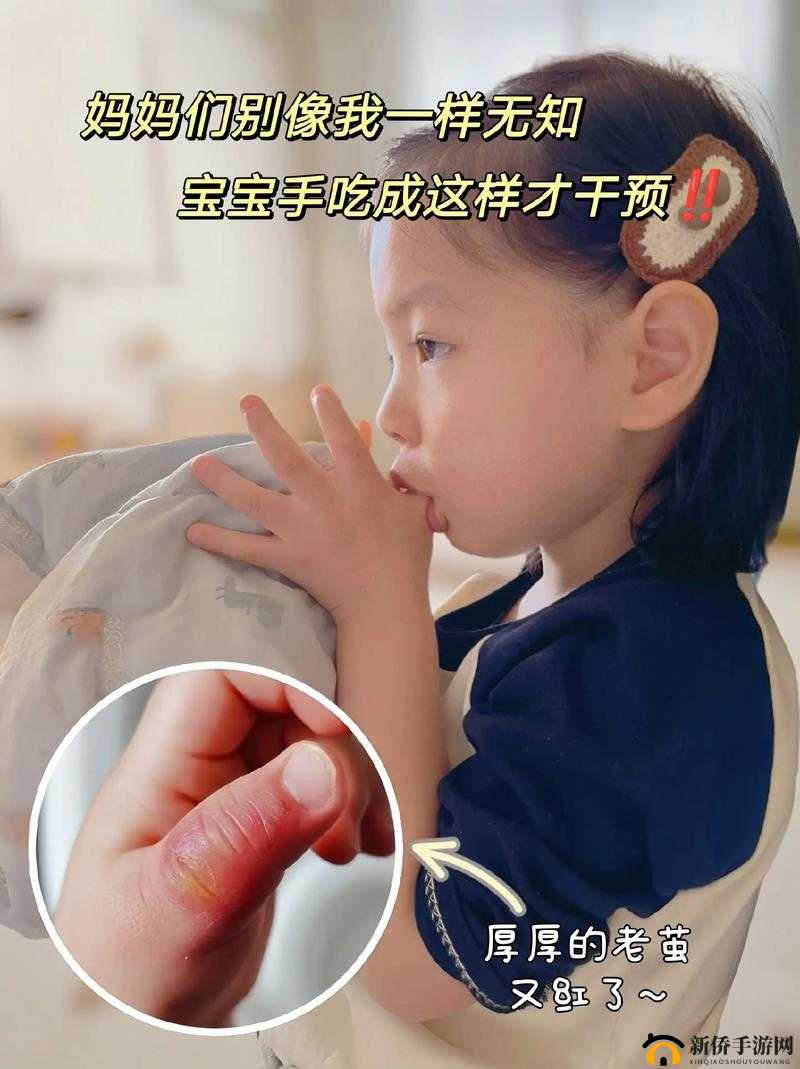 宝宝仅两根手指受伤却大哭不止令人揪心