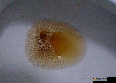 尿在肚子里不能流出来肉到底是怎么回事呢